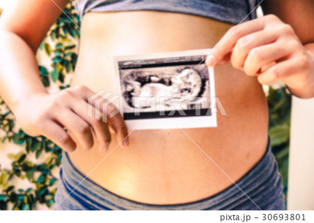 Pregnant Woman Holding Ultrasound Scan Photo blur background Pregnant Woman Holding Ultrasound Scan Photo blur background 30693801