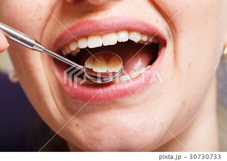 dentistry, dental , mouth and teeth close up 30730733