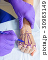 Plastic Surgeon Doctor Marking Hand of Woman 30963149