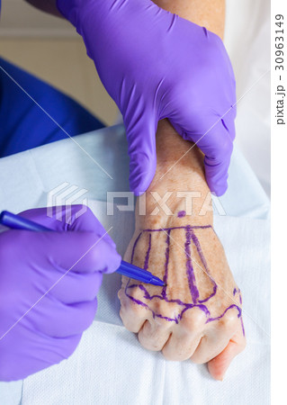 Plastic Surgeon Doctor Marking Hand of Woman 30963149