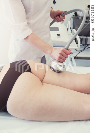 rf lifting procedure 30971185