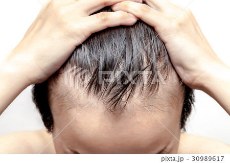 Bald man or woman worry about less hairline 30989617