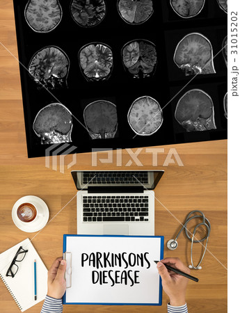 Parkinsons Disease doctor hand working doctor 31015202