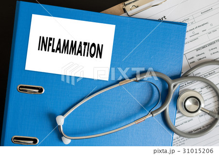 Inflammation Joint inflammation concept   , lymph 31015206