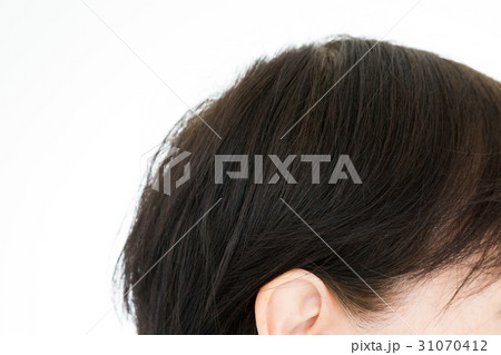 シニア　頭髪 31070412