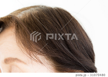 シニア　頭髪 31070480