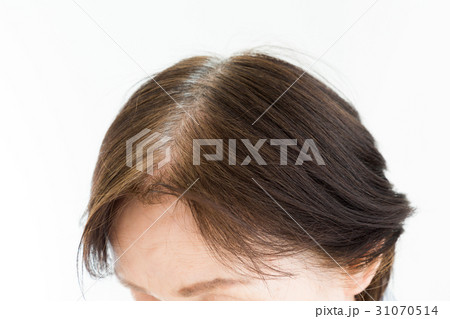 シニア　頭髪 31070514