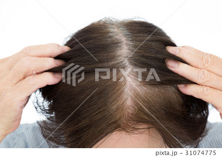 シニア　頭髪 31074775