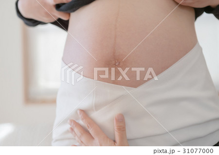 woman during pregnancy or shortly after childbirth woman during pregnancy or shortly after childbirth 31077000