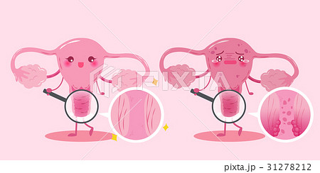 cute cartoon uterus 31278212