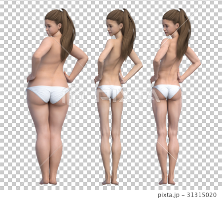 Diet image Before after After perming3dCG illustration material 31315020