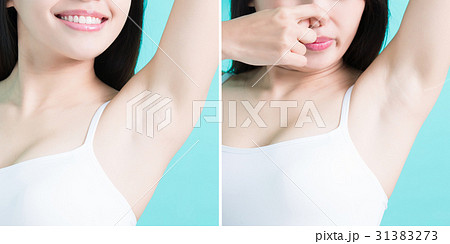 woman show under armpit 31383273