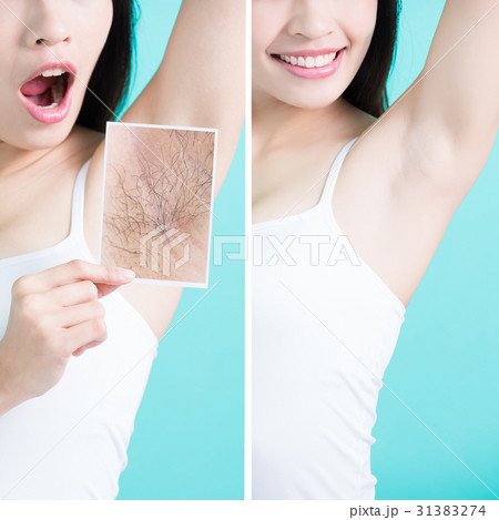 woman show under armpit 31383274