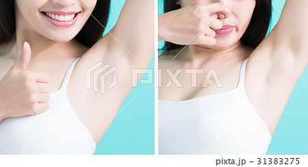 woman show under armpit 31383275