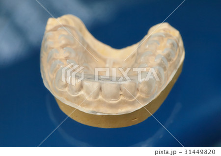 Dental prosthesis teeth mold, human gums model 31449820