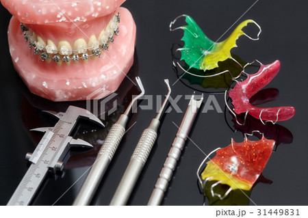 Jaw or teeth model with dental braces and tools 31449831