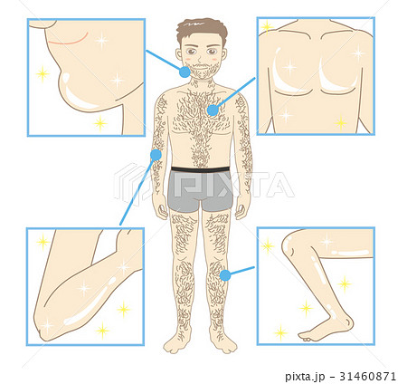 メンズエステ・全身脱毛ビフォーアフターB 31460871
