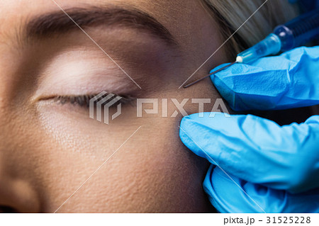 Woman receiving botox injection on her forehead 31525228