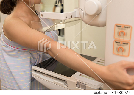 マンモグラフィー マンモグラフィー 31530025
