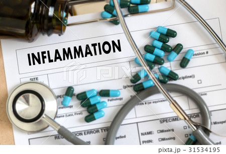 Inflammation Joint inflammation concept   , lymph 31534195