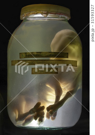 The embryo calf in formaldehyde 31593327