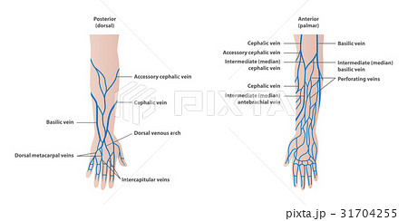 Vein plotting in the arm  illustration vector 31704255