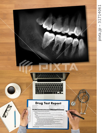 Dental x-ray Doctor holding and looking and Dental x-ray Doctor holding and looking and 31714061