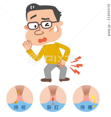 痔　男性　イラスト 31849339