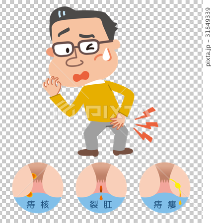 痔　男性　イラスト 31849339
