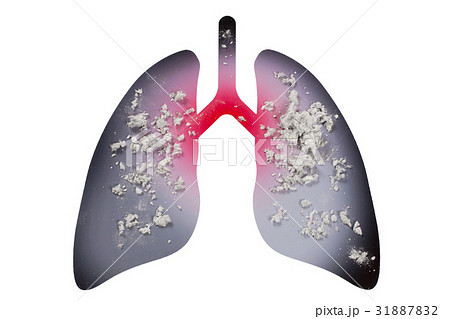 アスベスト被害イメージ 31887832