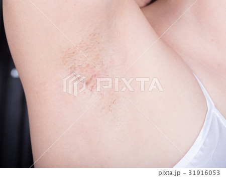 armpit of woman with hair armpit of woman with hair 31916053
