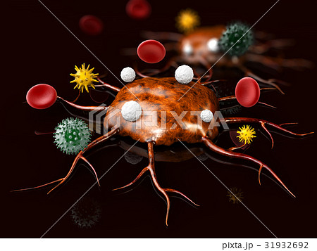 Cancer cells with blood cells and other bacteria Cancer cells with blood cells and other bacteria 31932692