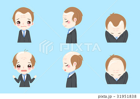 businessman with baldness 31951838