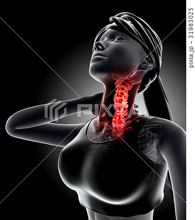 Neck painful cervica spine x-ray, 3D illustration. 31983025