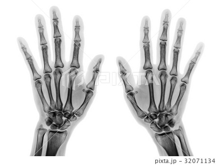 normal human hands on white background( isolated ) 32071134