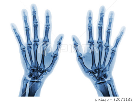 normal human hands on white background( isolated ) 32071135