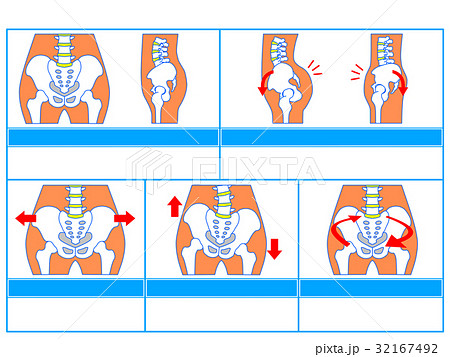 骨盤のゆがみ・分類図1（青色・説明なし） 32167492