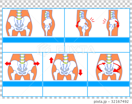 骨盤のゆがみ・分類図1（青色・説明なし） 32167492