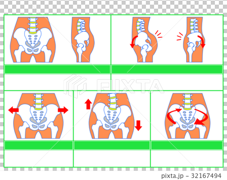 骨盤のゆがみ・分類図3(緑色・説明なし) 骨盤のゆがみ・分類図3(緑色・説明なし) 32167494