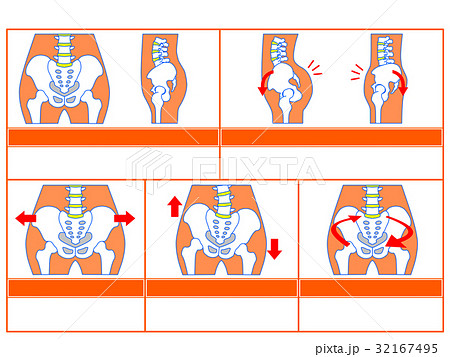 骨盤のゆがみ 分類図4 オレンジ色 説明なし のイラスト素材