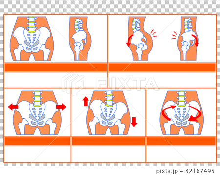 骨盤のゆがみ・分類図4（オレンジ色・説明なし） 32167495