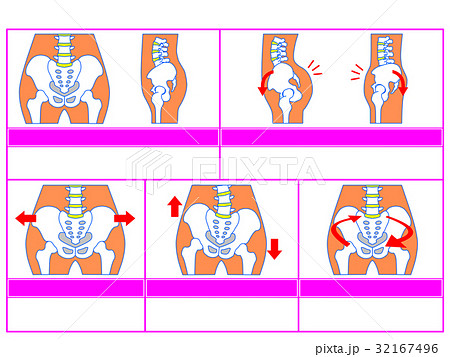 骨盤のゆがみ・分類図5（ピンク色・説明なし） 32167496