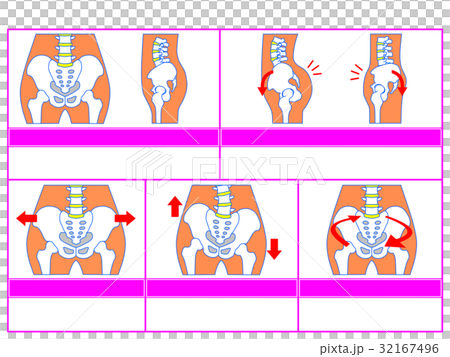 骨盤のゆがみ・分類図5（ピンク色・説明なし） 32167496