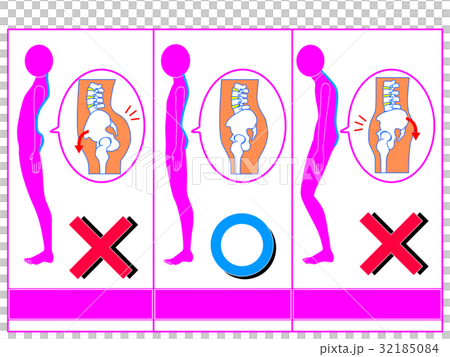 Comparison of distortion of pelvis (anterior tilt / normal / posterior tilt) pink color 2 Comparison of distortion of pelvis (anterior tilt / normal / posterior tilt) pink color 2 32185084