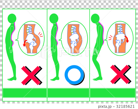 Comparison of distortion of pelvis (anterior tilt / normal / posterior tilt) Green 2 32185621