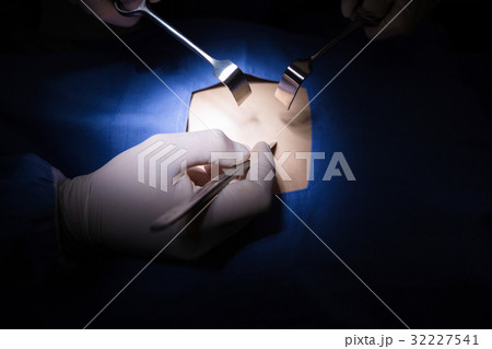 Surgeons performing operation in operation theater Surgeons performing operation in operation theater 32227541