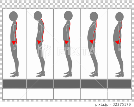 Type of posture (gray · no explanation) 32275179