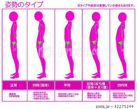 姿勢のタイプ（ピンク色） 32275244
