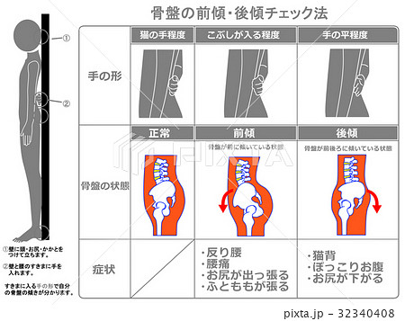 骨盤の前傾・後傾チェック法(灰色・説明あり) 骨盤の前傾・後傾チェック法(灰色・説明あり) 32340408