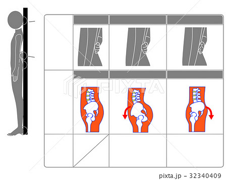 骨盤の前傾・後傾チェック法（灰色・説明なし） 32340409